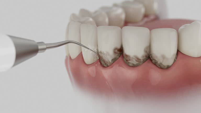 Trusted Tooth Extraction service in Woodland Beach, MI - Dentist Open Now